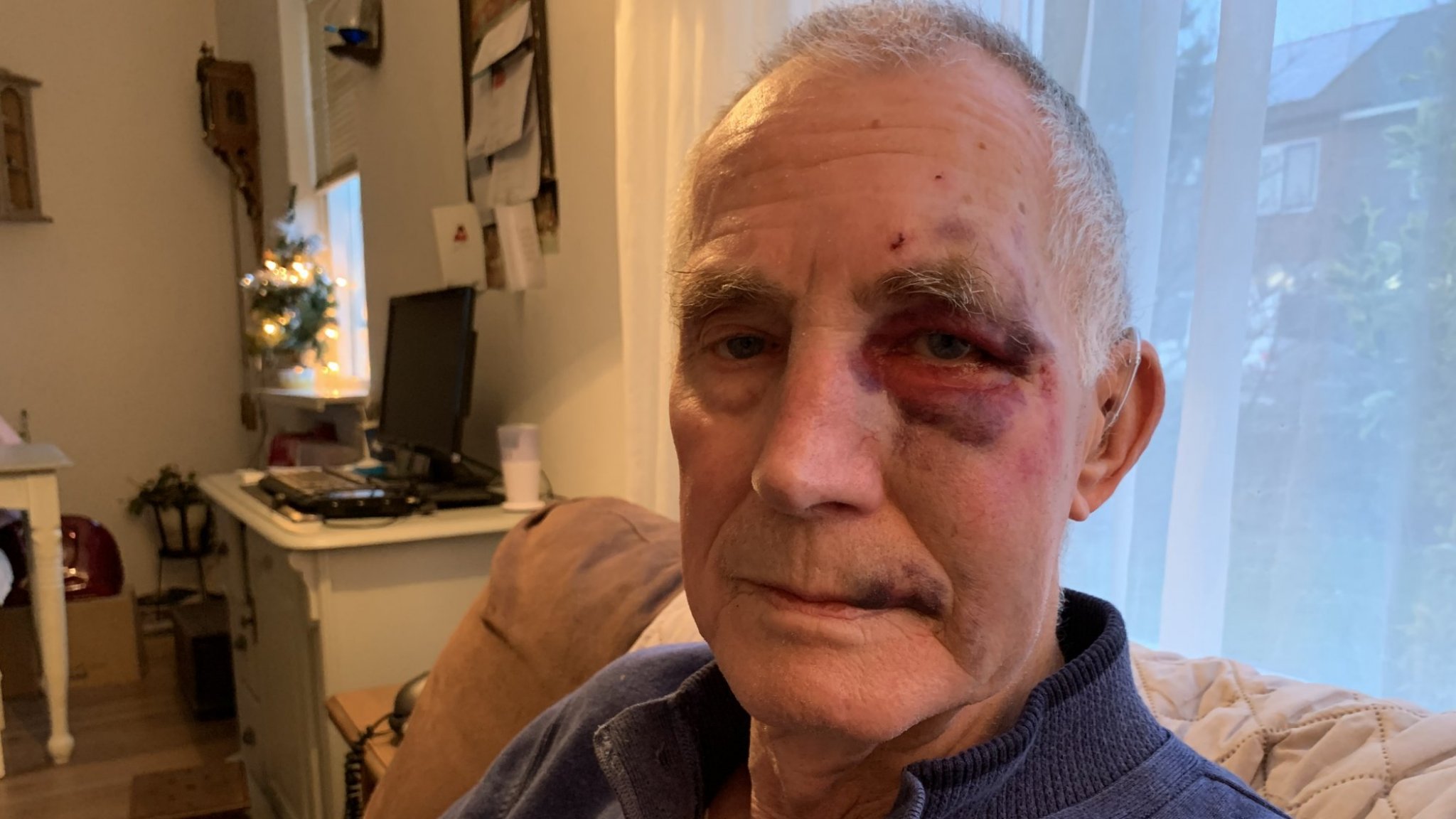 Siebe (73) sprak jongens aan op vuurwerk en werd mishandeld: 'Ik vind het zo laf' | RTL Nieuws