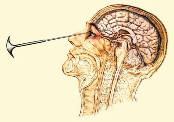 De weinig bekende smerige geschiedenis van de psychiatrie AnGeLWinGs