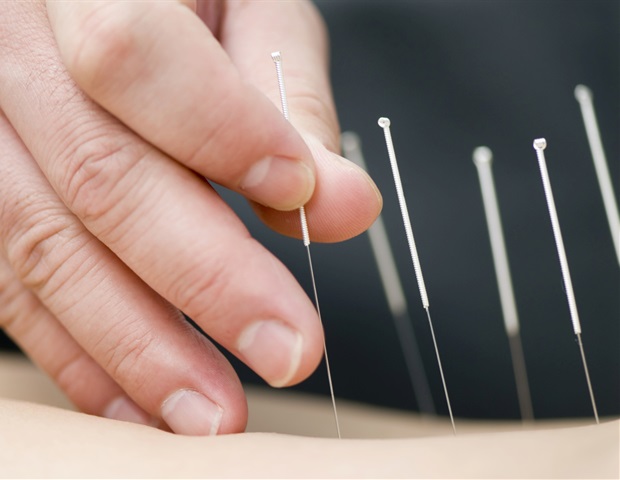 Researchers receive $2+ million grant to study acupuncture in emergency departments