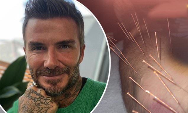 David Beckham shares VERY painful looking snap as he undergoes acupuncture treatment | Daily Mail Online