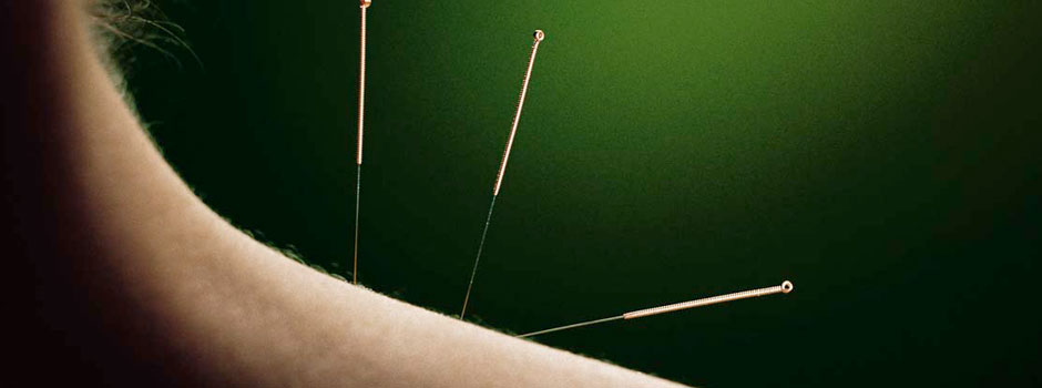 Acupuncture Awareness Day | Beroepsvereniging Zhong