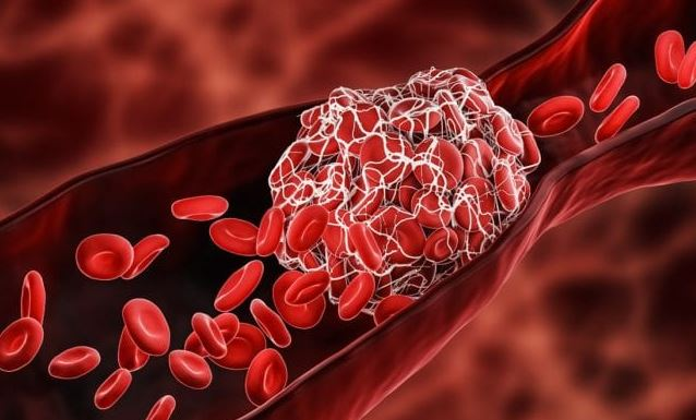 Bloedtransfusies van COVID-gevaccineerde mensen zijn besmet en brengen risico’s met zich mee, waarschuwen Japanse onderzoekers.. – Zorg Dat Je Niet Slaapt