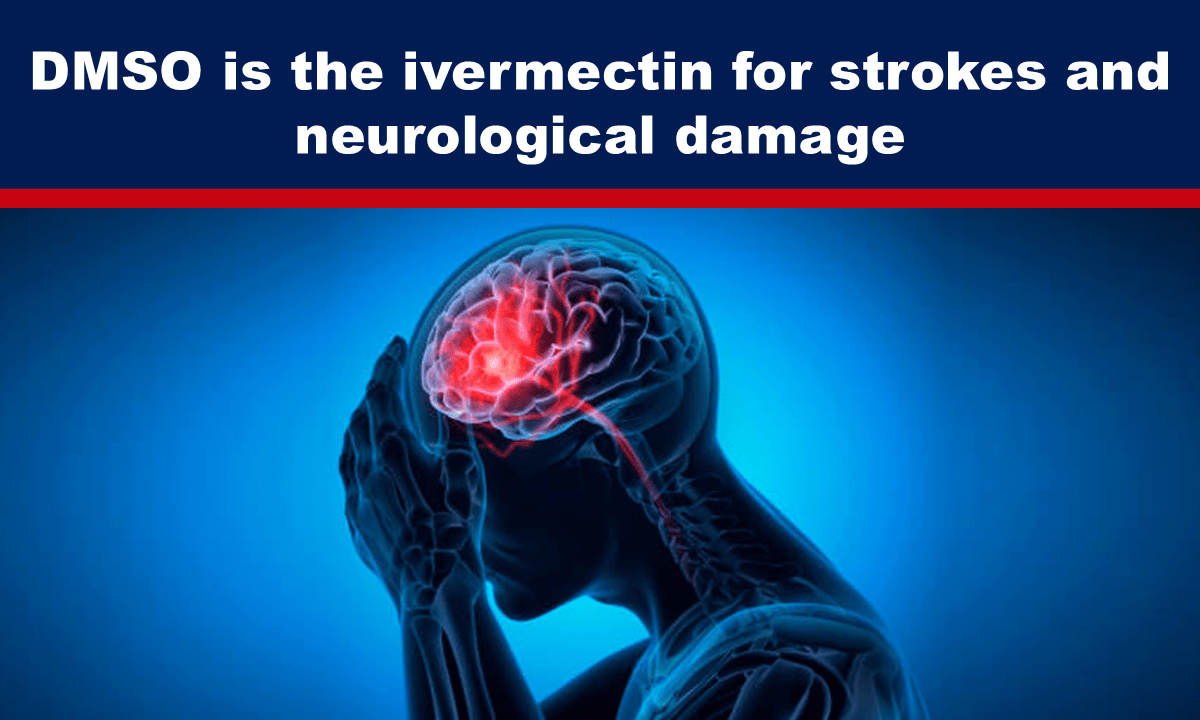 DMSO is the ivermectin for strokes and neurological damage – The Expose